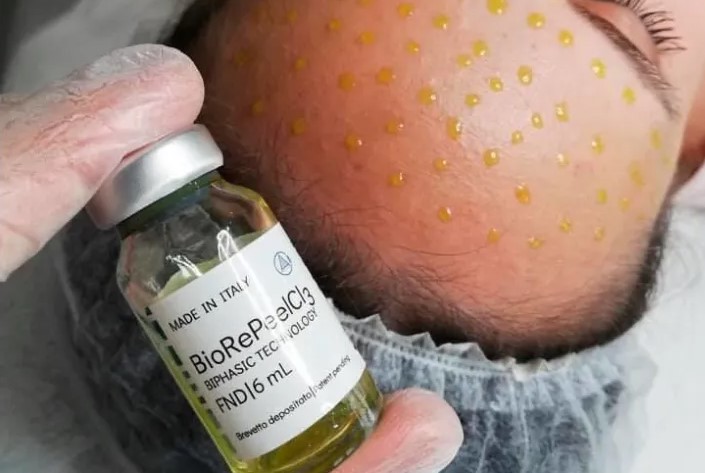 Book Melasma Treatment at LAZ Skincare