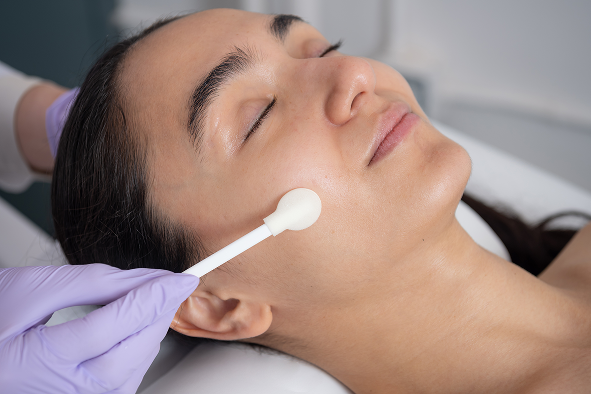 SkinBetter Science Peel at LAZ Skincare